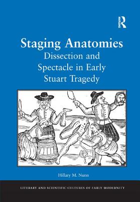 Staging Anatomies: Dissection and Spectacle in Early Stuart Tragedy - Nunn, Hillary M