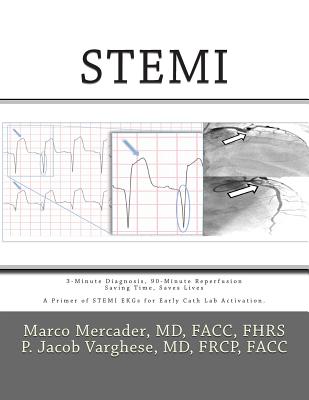 Stemi: 3-Minute Diagnosis, 90-Minute Reperfusion: Saving Time, Saves Lives - Varghese, P Jacob, MD, and Shams, Mortada A, MD, and Sullivan Bsc, Alexander E