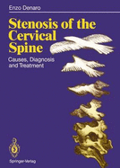 Stenosis of the Cervical Spine: Causes, Diagnosis and Treatment