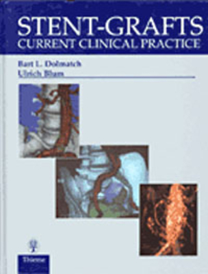 Stent-Grafts: Current Clinical Practice - Dolmatch, Bart L, and Blum, Ulrich