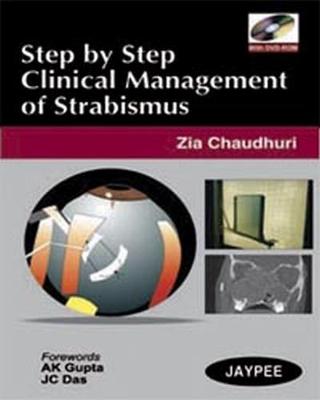Step by Step: Clinical Management of Strabismus - Chaudhuri, Zia