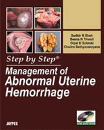 Step by Step Management of Abnormal Uterine Hemorrhage