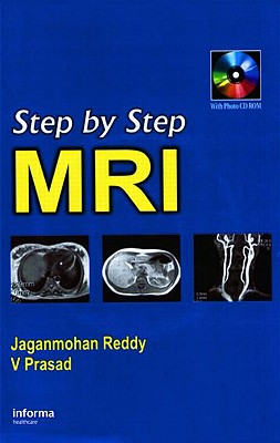 Step by Step MRI - Reddy, Jagan Mohan, and Prasad, V