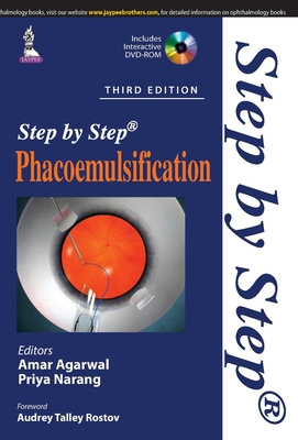 Step by Step Phacoemulsification - Agarwal, Amar (Editor), and Narang, Priya (Editor)