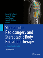 Stereotactic Radiosurgery and Stereotactic Body Radiation Therapy: A Comprehensive Guide