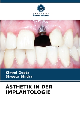 ?sthetik in Der Implantologie - Gupta, Kimmi, and Bindra, Shweta