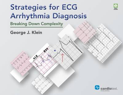 Strategies for ECG Arrhythmia Diagnosis: Breaking Down Complexity - Klein, George J