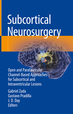 Subcortical Neurosurgery: Open and Parafascicular Channel-Based Approaches for Subcortical and Intraventricular Lesions - Zada, Gabriel (Editor), and Pradilla, Gustavo (Editor), and Day, J. D. (Editor)