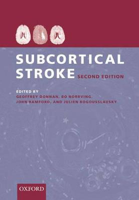 Subcortical Stroke - Donnan, Geoffrey