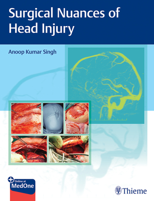 Surgical Nuances of Head Injury - Singh, Anoop (Editor)