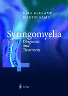 Syringomyelia: Diagnosis and Treatment