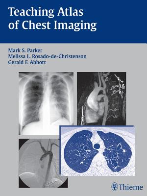 Teaching Atlas of Chest Imaging - Parker, Mark S, and Rosado-de-Christenson, Melissa L, MD, Facr, and Abbott, Gerald F, MD