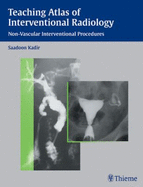 Teaching Atlas of Interventional Radiology: Non-Vascular Interventional Procedures - Kadir, Saadoon (Editor)