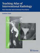 Teaching Atlas of Interventional Radiology: Non-vascular Interventional Procedures