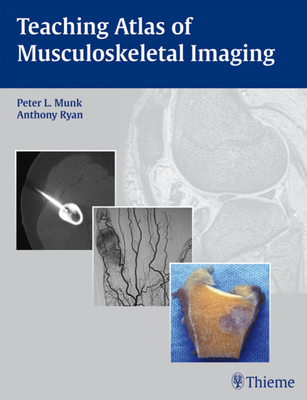 Teaching Atlas of Musculoskeletal Imaging - Munk, Peter L.