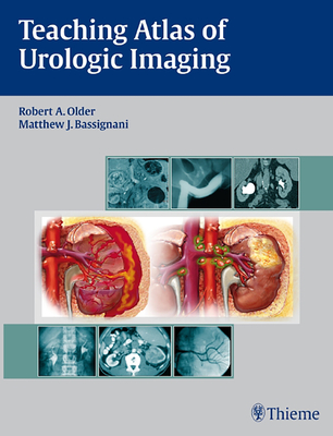 Teaching Atlas of Urologic Imaging - Older, Robert (Editor), and Bassignani, Matthew (Editor)