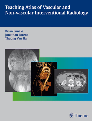 Teaching Atlas of Vascular and Non-Vascular Interventional Radiology - Funaki, Brian, and Lorenz, Jonathan M, and Van Ha, Thuong G