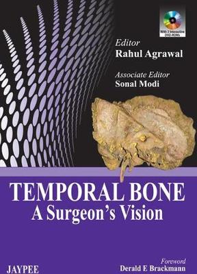 Temporal Bone: A Surgeon's Vision - Agrawal, Rahul
