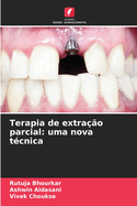 Terapia de extra??o parcial: uma nova t?cnica