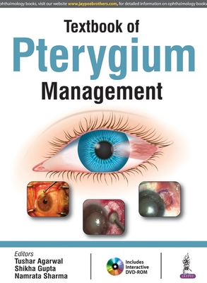 Textbook of Pterygium Management - Agarwal, Tushar, and Gupta, Shikha, and Sharma, Namrata