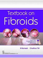 Textbook on Fibroids