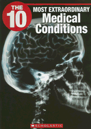 The 10 Most Extraordinary Medical Conditions