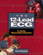 The 12-Lead ECG in Acute Myocardial Infarction
