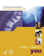 The 2004 Surgeon General's Report on Bone Health and Osteoporosis - What It Means to You