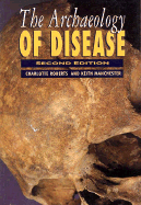 The Archaeology of Disease