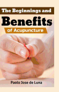 The Beginnings and Benefits of Acupuncture