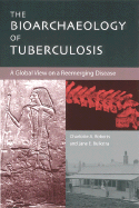 The Bioarchaeology of Tuberculosis: A Global View on a Reemerging Disease