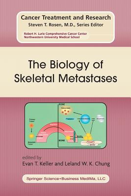 The Biology of Skeletal Metastases - Keller, Evan T (Editor), and Chung, Leland W K (Editor)