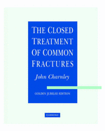 The Closed Treatment of Common Fractures - Charnley, John
