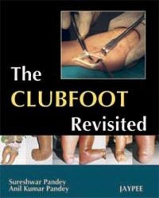 The Club Foot Revisited - Pandey, Sureshwar, and Pandey, Anil Kumar