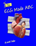 The ECG Made ABC