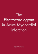 The Electrocardiogram in Acute Myocardial Infarction