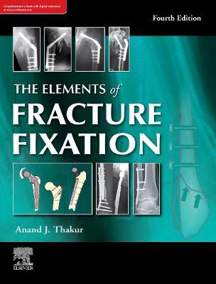 The elements of fracture fixation, 4e - Thakur, Anand J.