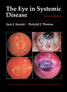 The Eye in Systemic Disease - Kanski, Jack J, MD, MS, Frcs