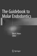 The Guidebook to Molar Endodontics