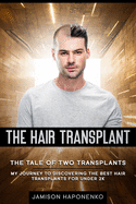 The Hair Transplant: The Tale Of Two Transplants my journey to discovering the best transplants for under 2k