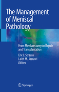 The Management of Meniscal Pathology: From Meniscectomy to Repair and Transplantation