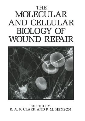 The Molecular and Cellular Biology of Wound Repair - Clark, R a F, and Henson, P M