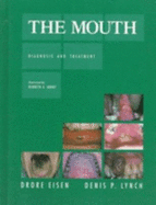 The Mouth: Diagnosis and Treatment