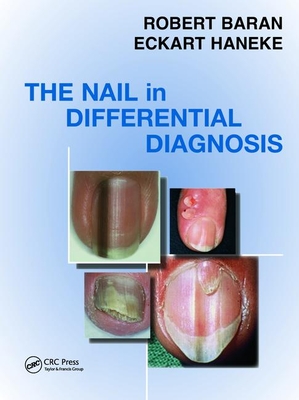 The Nail in Differential Diagnosis - Baran, Robert, MD, and Haneke, Eckart, MD