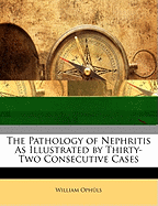 The Pathology of Nephritis as Illustrated by Thirty-Two Consecutive Cases