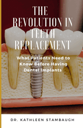 The Revolution in Teeth Replacement: What Patients Need to Know Before Having Dental Implants