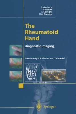 The Rheumatoid Hand: Diagnostic Imaging - Garlaschi, G, and Genenat, H K (Foreword by), and Silvestri, E