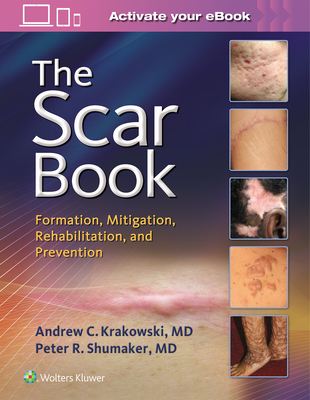 The Scar Book: Formation, Mitigation, Rehabilitation and Prevention - Krakowski, Andrew C, Dr., and Shumaker, Peter R, Dr.