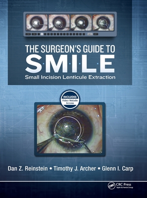 The Surgeon's Guide to SMILE: Small Incision Lenticule Extraction - Reinstein, Dan, and Archer, Timothy, and Carp, Glenn, (Sa)