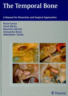 The the Temporal Bone: A Manual for Dissection and Surgical Approaches - Sanna, Mario, and Khrais, Tarek, and Falcioni, Maurizio